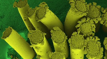 Multiple tube-like reproductive structures (aecia) of stem rust protruding from Berberis vulgaris. SEM photography by Kim Findlay, John Innes Centre