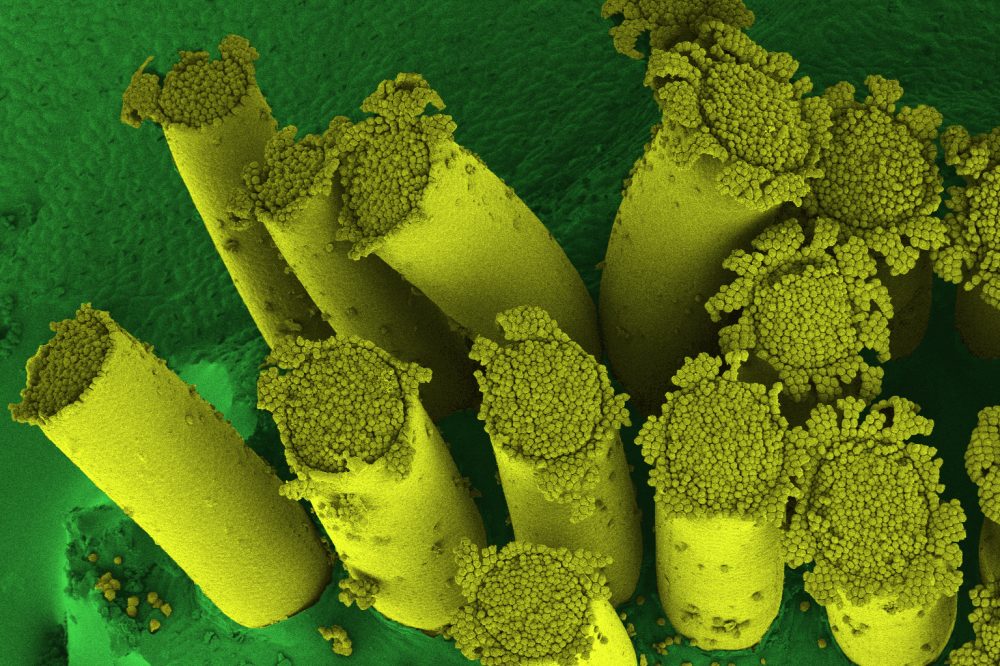 Multiple tube-like reproductive structures (aecia) of stem rust protruding from Berberis vulgaris. SEM photography by Kim Findlay, John Innes Centre