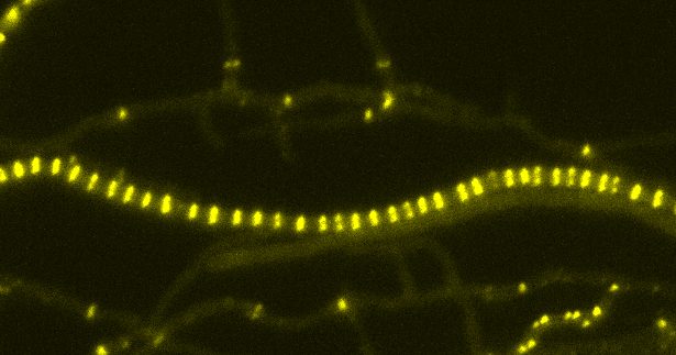 Research uncovers a critical factor in the assembly of cell division machinery in bacteria